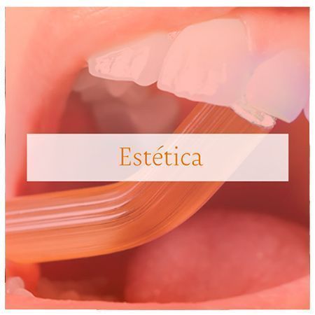 Los mejores tratamientos de estética oral en Valencia